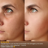 CREMA INFIBELLA-REDUCE LINEAS DE EXPRESION